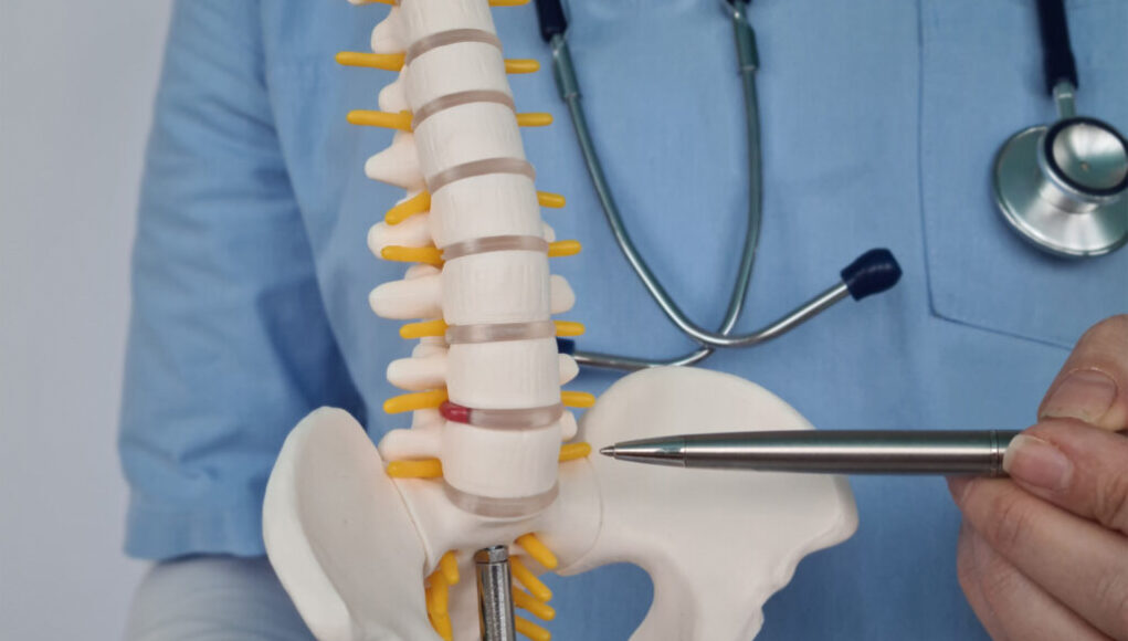 AI-Driven Diagnostics on Detection of Spinal Degeneration Spinal Degeneration